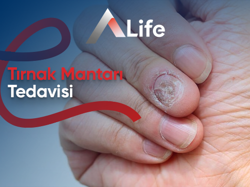 Tırnak Mantarı Tedavisi